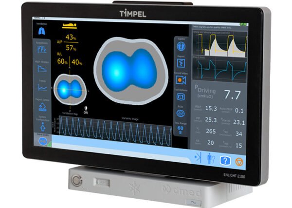 Timpel Enlight 2100 Elektriksel Empedans Tomografisi (EIT) Cihazı - Görsel 5