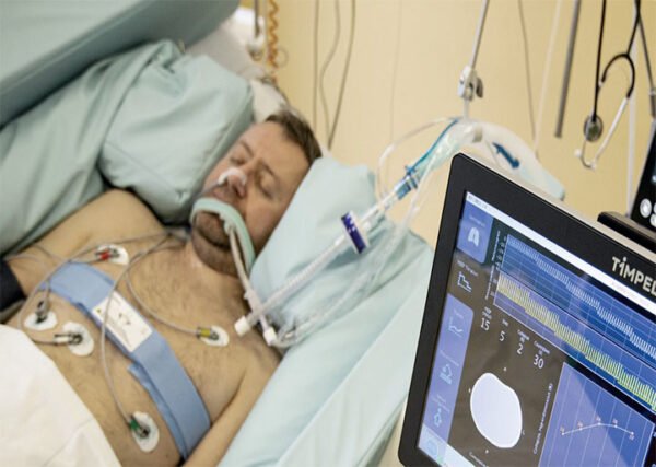 Timpel Enlight 2100 Elektriksel Empedans Tomografisi (EIT) Cihazı - Görsel 7